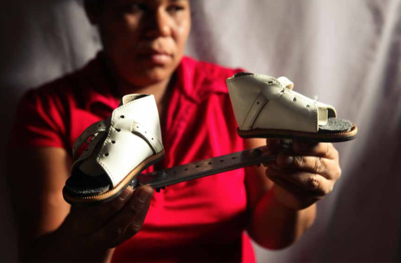 Una madre muestra los zapatos especiales que utilizaba su hija, al nacer con una deformación en sus huesos. El padre de la niña trabajaba en la mina y toda la familia estaba expuesta al agua contaminada de la zona. La pequeña murió a los cinco años de edad.